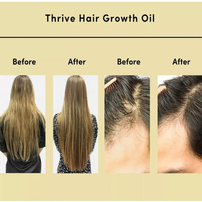 Natural Hair Growth Oil